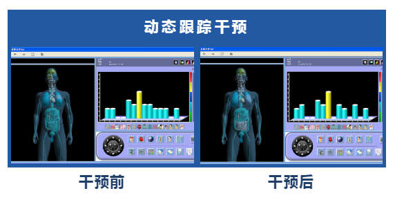 艾灸設(shè)備 艾灸設(shè)備